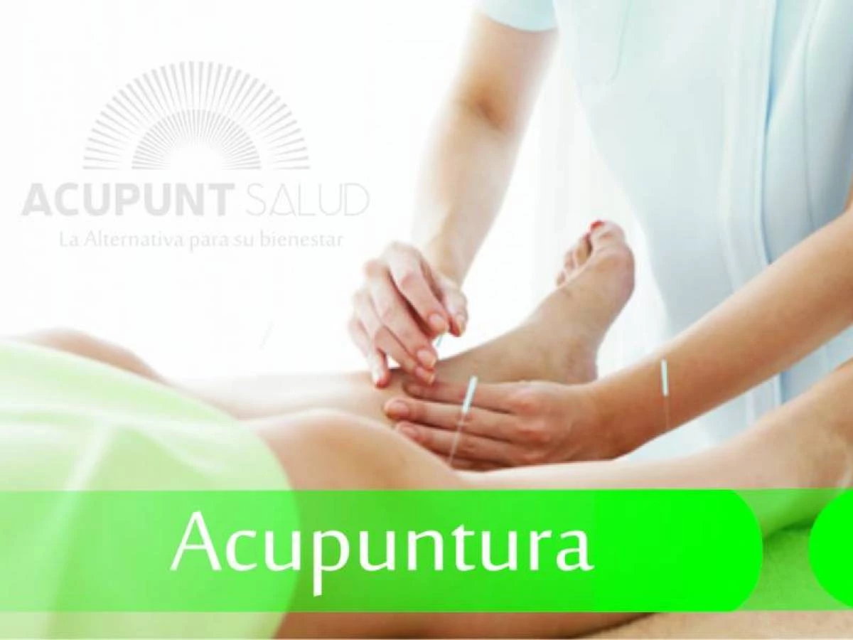 ACUPUNTSALUD
