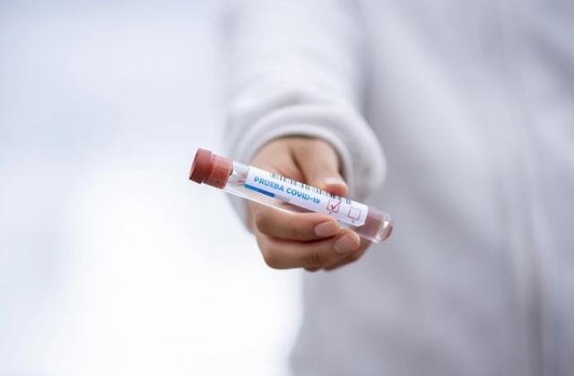 Se ralentiza el número de contagios por coronavirus en Majadahonda esta semana
