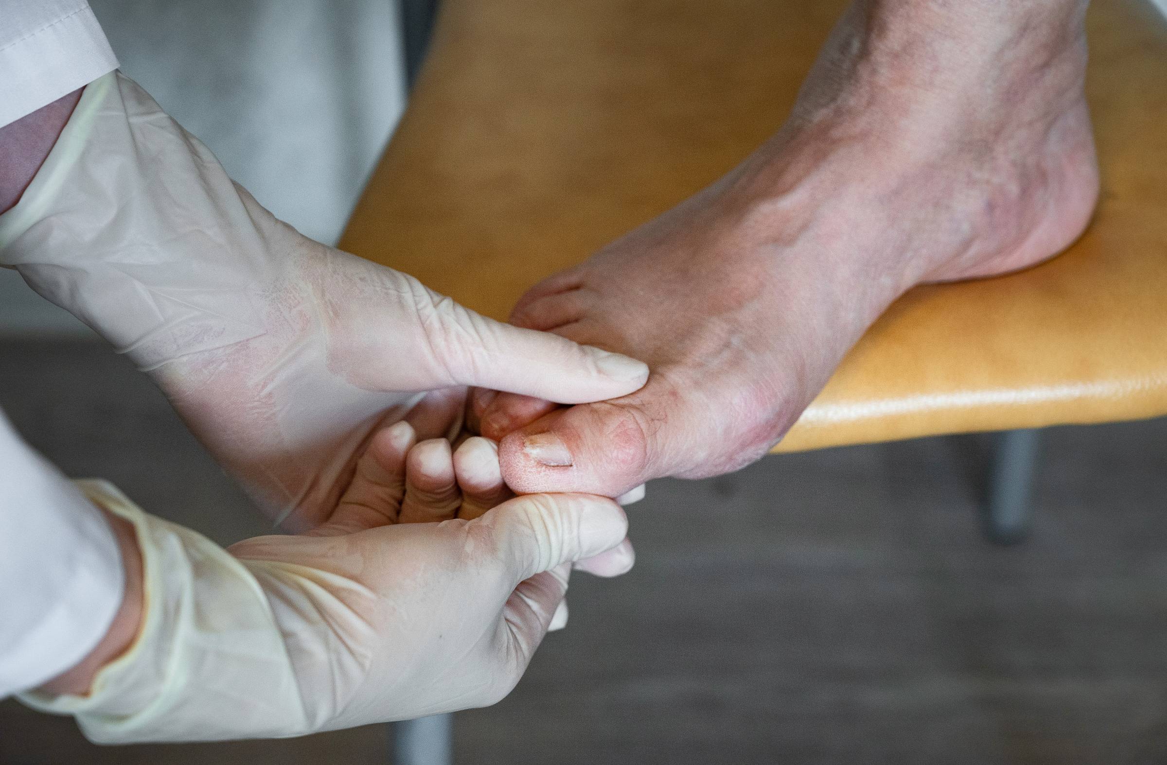 Majadahonda abre la solicitud de ayudas para los tratamientos podológicos de los mayores